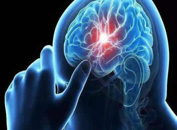 脑卒中疾病预防的相关知识
