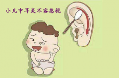 儿童中耳炎不容忽视