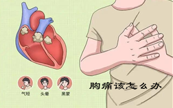 胸痛你该怎么办——四川现代医院心血管内科分享