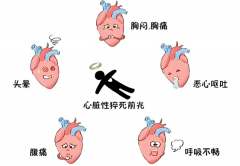 与死神赛跑，这4分钟决定生死！心脏猝死急救，人人必学！